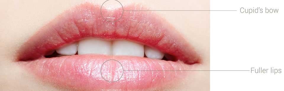 Lip Enhancements and augmentation banner image